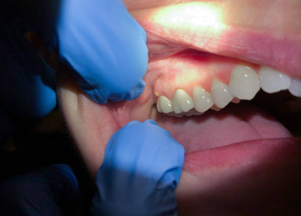 Best Emergency Treatment for Toothache in Smithton, IL