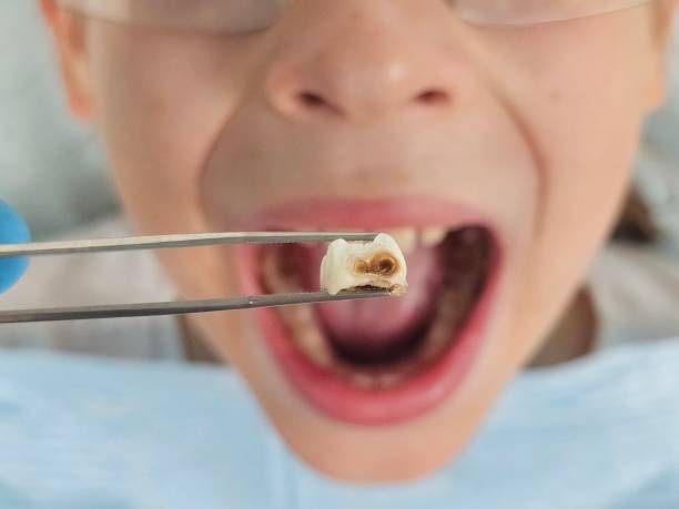 Best After-Hours Emergency Dentist in Smithton, IL