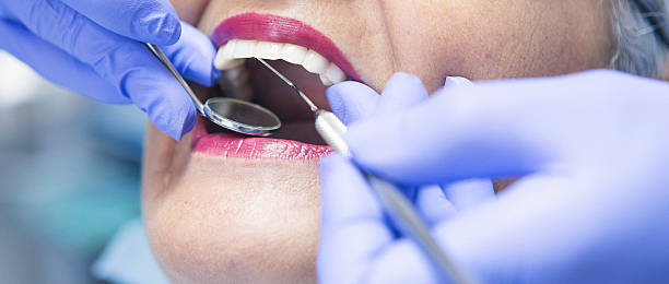 Best Emergency Broken Tooth Repair in Smithton, IL